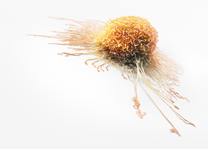 Invasive-Cancer-Cell