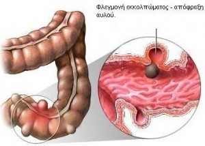 ekkolpomata12