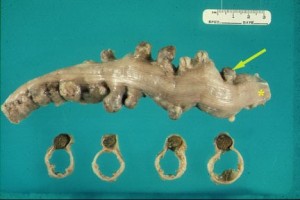ekkolpomata33