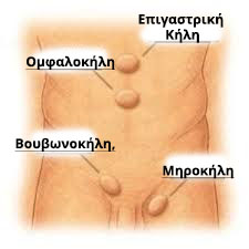 κηλη