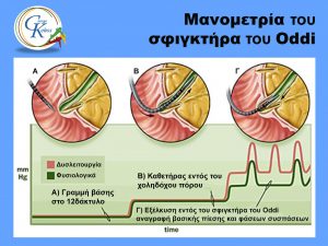 Μανομετρία Σφιγκτήρα Oddi