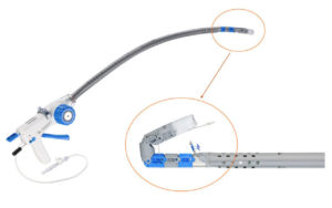 The EsophyX Z Device